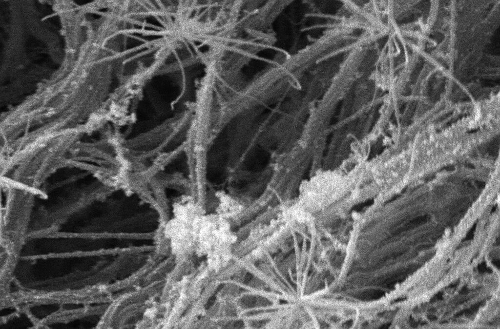 Estructura submicrométrica de entramado de fibrina en un coágulo